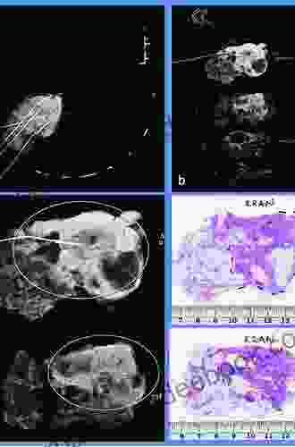 Multidisciplinary Teaching Atlas of the Pancreas: Radiological Surgical and Pathological Correlations