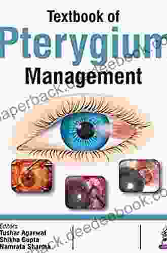 Textbook of Pterygium Management Tushar Agarwal